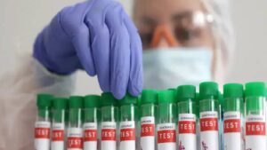 देश के इस इलाके में फैला बर्ड फ्लू, H5N1 वायरस से सैकड़ों कौवों की मौत; सरकार ने जारी की एडवाइजरी​on February 6, 2026 at 5:09 am