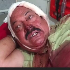 मंडी में बेटे-बहू ने पिता को दराट-डंडों से पीटा:गंभीर हालत में अस्पताल में भर्ती, घर का ताला तोड़ने से रोकने पर हुआ विवाद