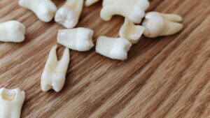 गलती से दांत निगलना पड़ा भारी, खाने की नली में फंसा; जानें कैसे मौत के मुंह से लौटा वापस​on April 3, 2026 at 3:28 pm